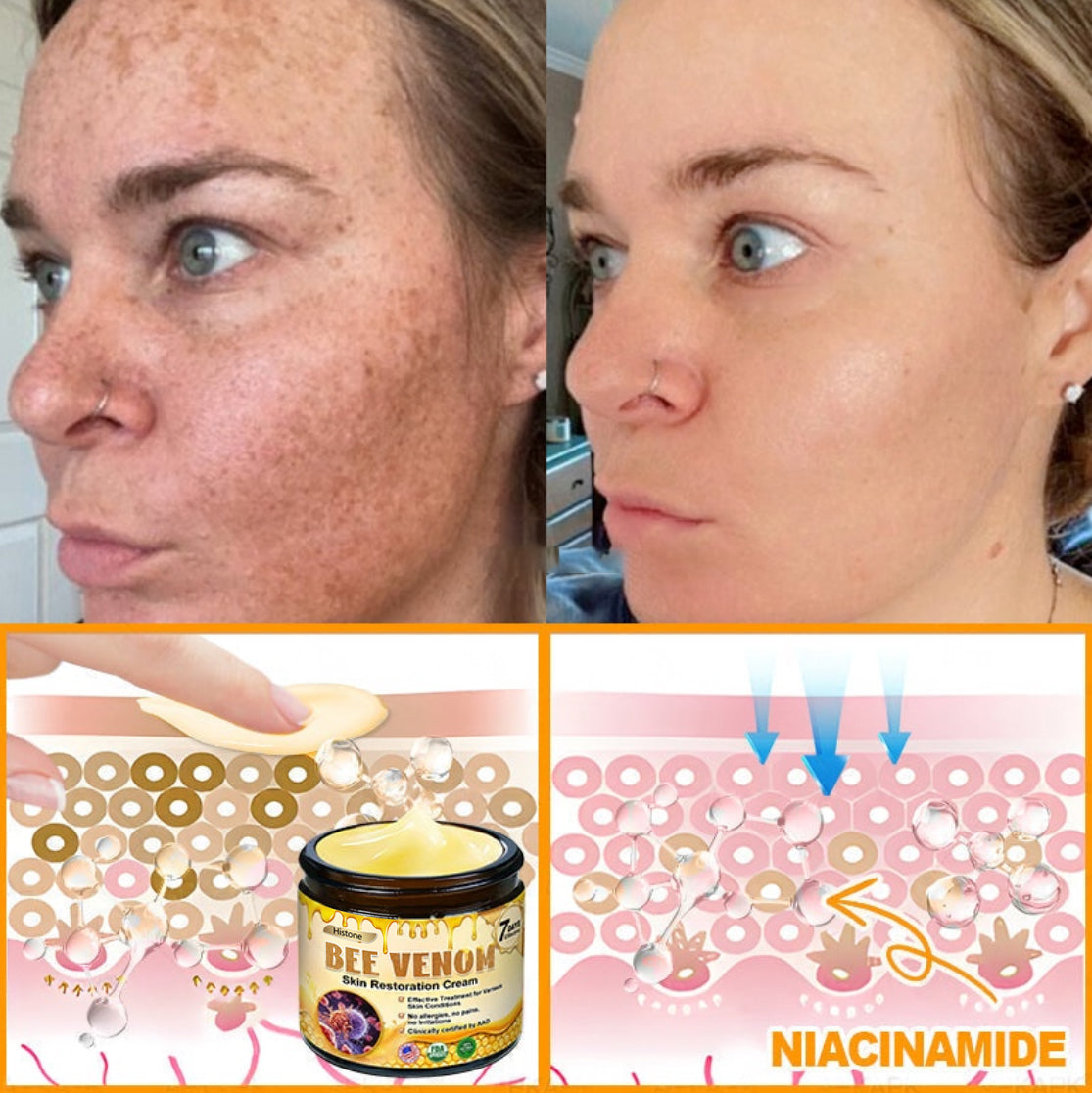 Made and Shipped from USA ✨Histone® 𝖡𝖾𝖾 𝗏𝖾𝗇𝗈𝗆 𝖲𝗄𝗂𝗇 𝖱𝖾𝗌𝗍𝗈𝗋𝖺𝗍𝗂𝗈𝗇 𝖢𝗋𝖾𝖺𝗆