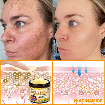 Made and Shipped from USA ✨Histone® 𝖡𝖾𝖾 𝗏𝖾𝗇𝗈𝗆 𝖲𝗄𝗂𝗇 𝖱𝖾𝗌𝗍𝗈𝗋𝖺𝗍𝗂𝗈𝗇 𝖢𝗋𝖾𝖺𝗆